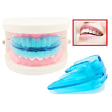 Utility Tooth Orthodontic Appliance,Blue Silicone Hot Professional Alignment Braces,Oral Hygiene Dental Care Equipment For Teeth